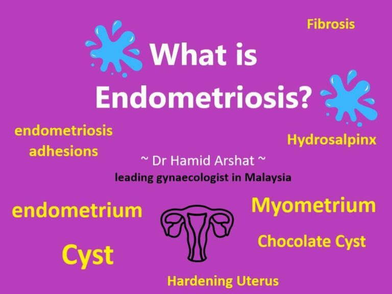 Endometriosis: What Every Woman Needs to Know